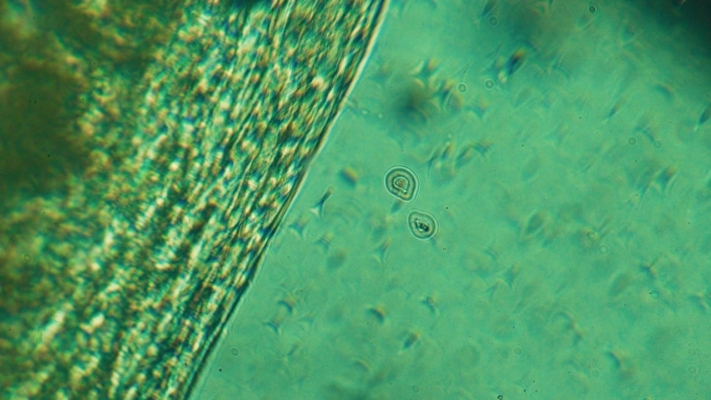 Why Modern Cannabis Culture Looks Nothing Like 2016 3 Image Of Microscopic Green Texture